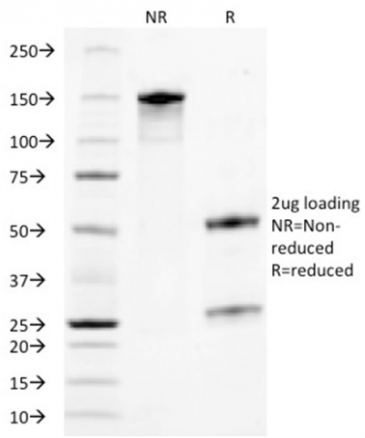 Data from SDS-PAGE analysis of Anti-TROP2 antibody (Clone TACSTD2/2153). Reducing lane (R) shows heavy and light chain fragments. NR lane shows intact antibody with expected MW of approximately 150 kDa. The data are consistent with a high purity, intact mAb.